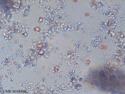 phyto/Pertuis Charentais/Tasdon_st2/PAMPAS 2019-2021/Tetraedron triangulare (TASDON_St2_140319-060).tif(copy)_thumb.jpg